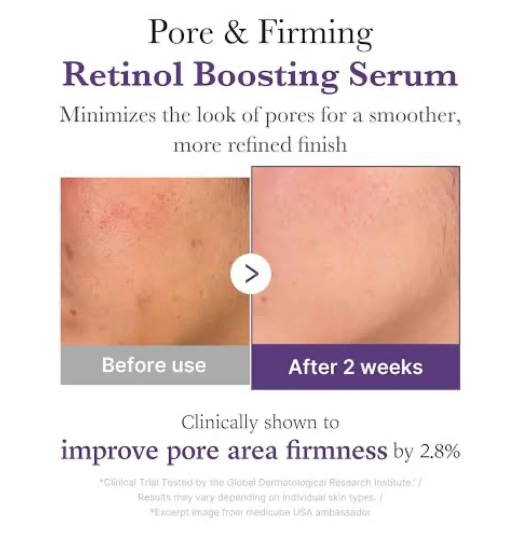 MEDICUBE Retinol NMN Boosting Serum 30mL - Image 7